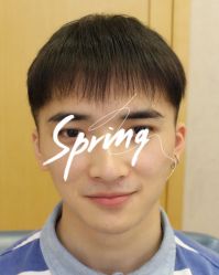 -大麦微针植发全国连锁