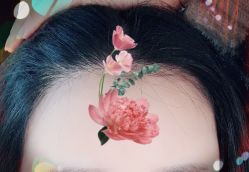 -大麦微针植发全国连锁