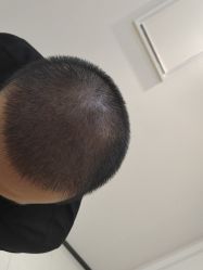 -雍禾植发全国连锁