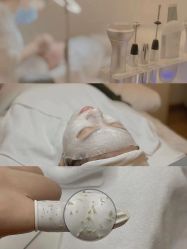 -美肤盾祛痘·问题肌头疗管理中心