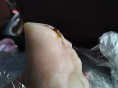 -张果佬年糕卷(科巷店)