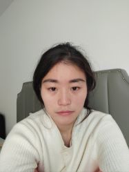体验后-大麦微针植发丨全国连锁