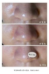 脸部抗衰-光SPA科技美肤