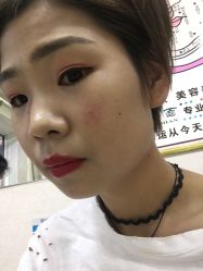 点击看大图 -北京美痣堂古方祛痣斑疣瘊