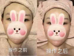 -FACE·日本小颜矫正美容整骨サロン