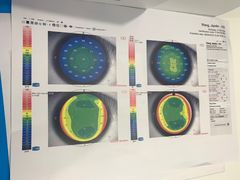 -杭州明视康眼科医院