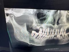 -咿呀口腔(光谷分院)