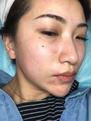 -上海玫瑰医疗美容医院