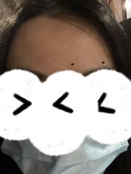 体验后-深圳美莱医疗美容医院