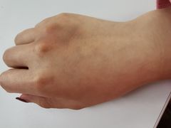 -悦和堂中医门诊部·疼痛调理·针灸推拿·艾灸拔罐