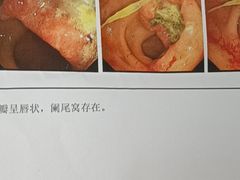 -上海市第四人民医院