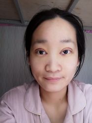 体验后-西安壹加壹医疗美容·西北抗衰旗舰店