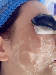 体验前-四川米兰柏羽医学美容医院