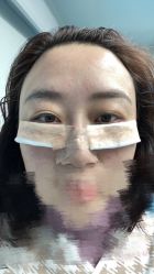 体验前-北京博泽医疗美容门诊部