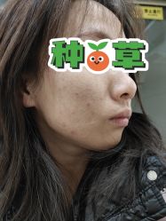 体验前-北京英煌医疗美容