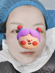 体验后-重庆联合丽格美容医院
