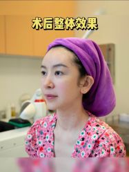 -北京米扬丽格医疗美容·联合丽格鼻整形中心