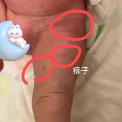 -爱陪伴一对一月子中心(融侨店)