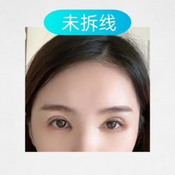 -素美医疗美容·西南眼鼻整形·修复基地