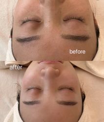 点击看大图 -栖SPA·ONDA ·海菲秀·皑皑科技美肤中心