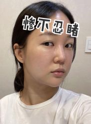 -广州美莱医疗美容医院