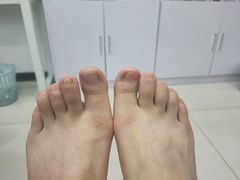 -世龙世家甲沟炎·灰指甲·嵌甲矫正·修脚(武侯区双楠店)