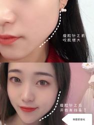 点击看大图 -AIST爱思特医疗美容医院