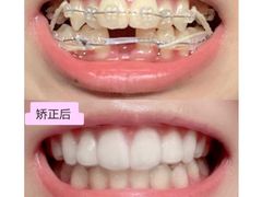 -极光口腔·矫正种植修复(锦江店)