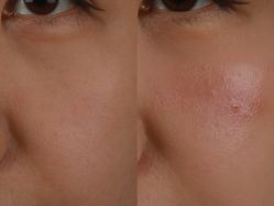 -北京米扬丽格医疗美容·联合丽格鼻整形中心