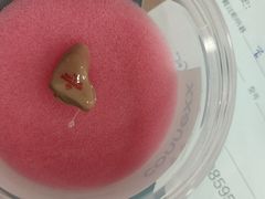 -自然之声助听器·呼吸机(贵定店)