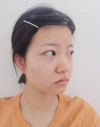 -深圳悦她医疗美容