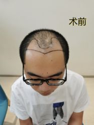 -雍禾植发全国连锁