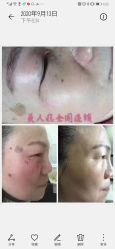 -美人痣全国连锁
