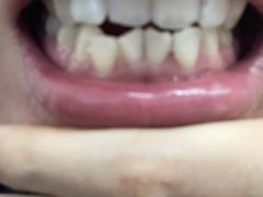 -微笑牙科口腔(三亚迎宾院区)