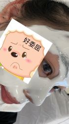 -塑青春&伊肤泉祛痘皮肤管理