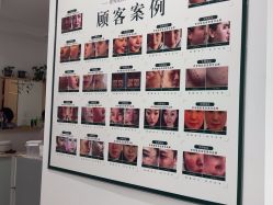 -瓷肌博士·祛痘科技美肤