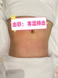 点击看大图 -Lily纤美·科技减脂中心