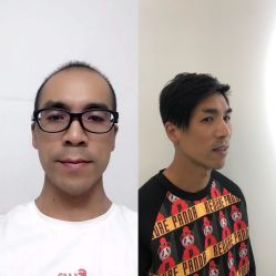 -发饰美男士增发补发假发定制店