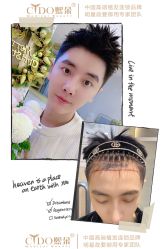 -熙朵美学植发·连锁品牌