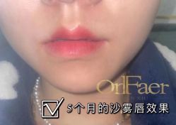 -OnFaer.纹眉半永久无创洗眉