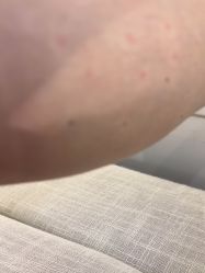 -agge蛋白医美