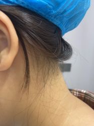 -美瑞莎创美医疗美容