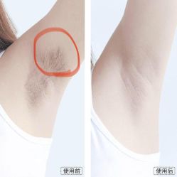 -小忠丽格医美