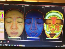 皮肤诊断-光SPA科技美肤