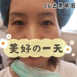 体验后-上海玫瑰医疗美容医院