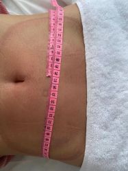 -肥三针腧穴瘦身馆