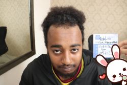 点击看大图 -大麦微针植发丨全国连锁