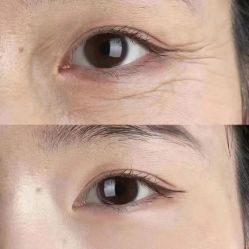 -紫洁俪方（北京）医疗美容