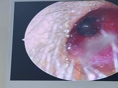 -溥耳·可视采耳·头疗·沐眼