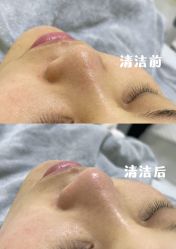 -盘子画美甲美睫美肤